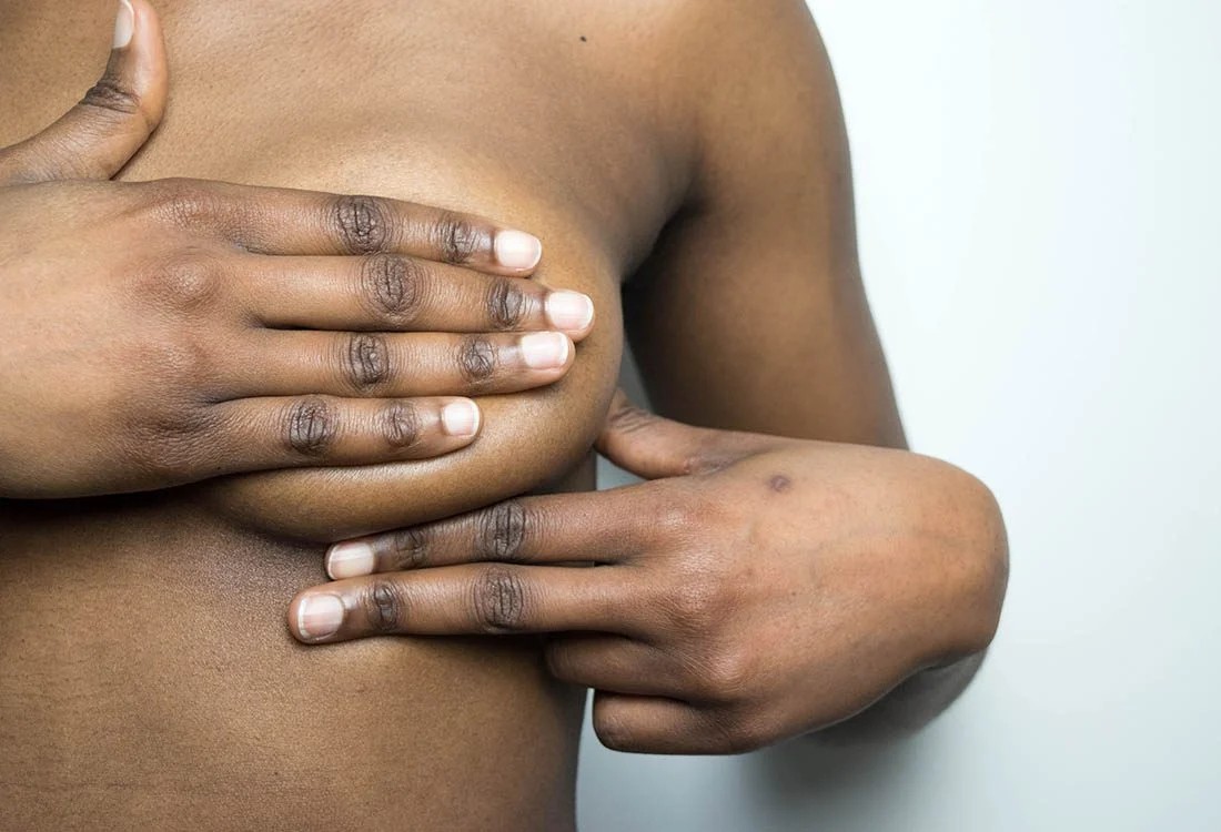 Cancer du sein : Octobre Rose rappelle l’urgence du dépistage au Niger
