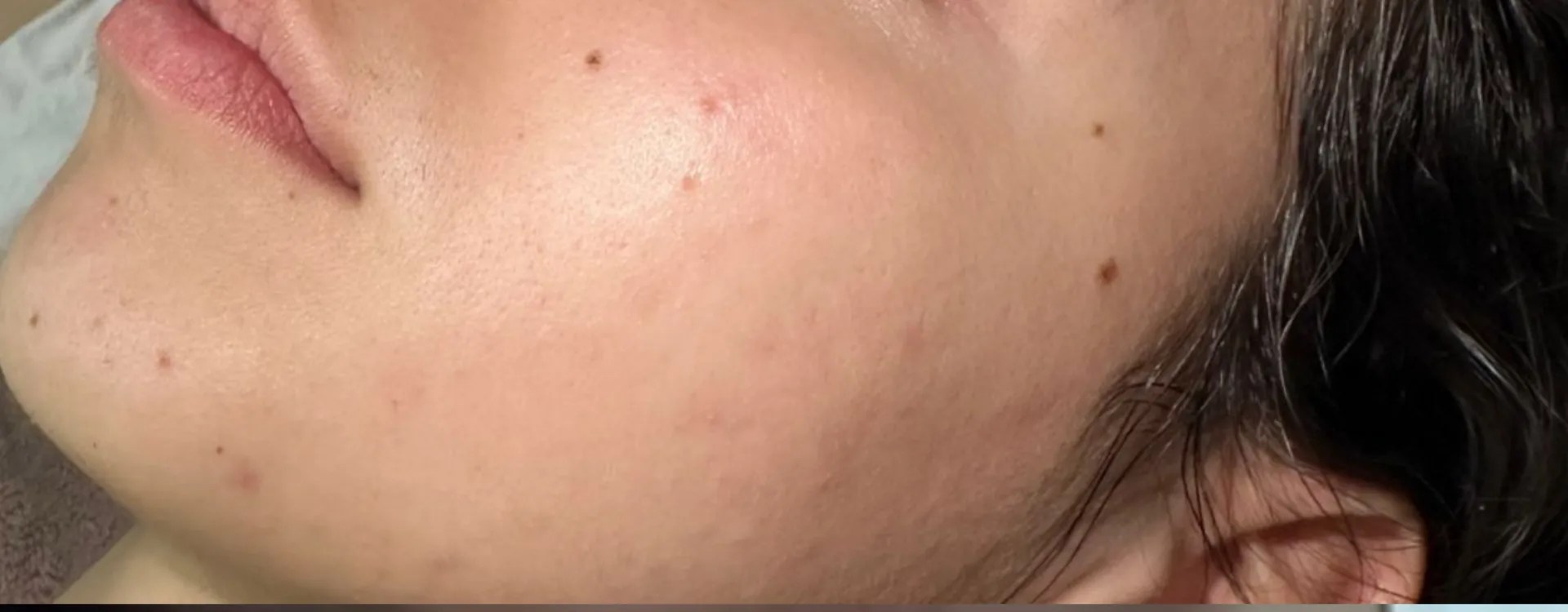 After Image