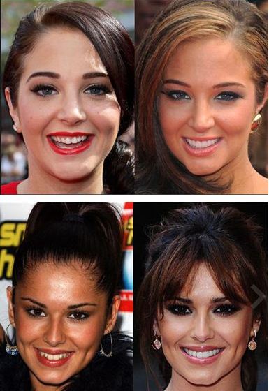 Cheryl cole had her teeth done after shooting to fame (image: Cheryl Cole