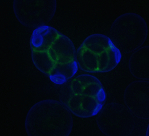 SPS2-GFP_3D2