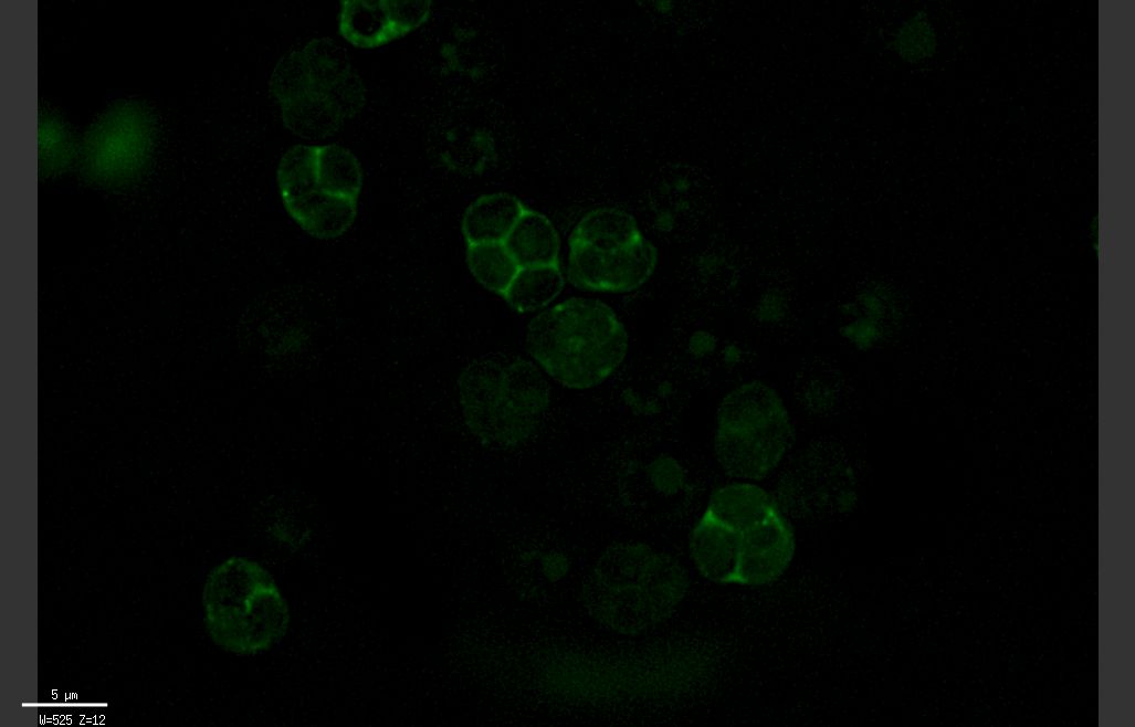 SPS2-GFPbis