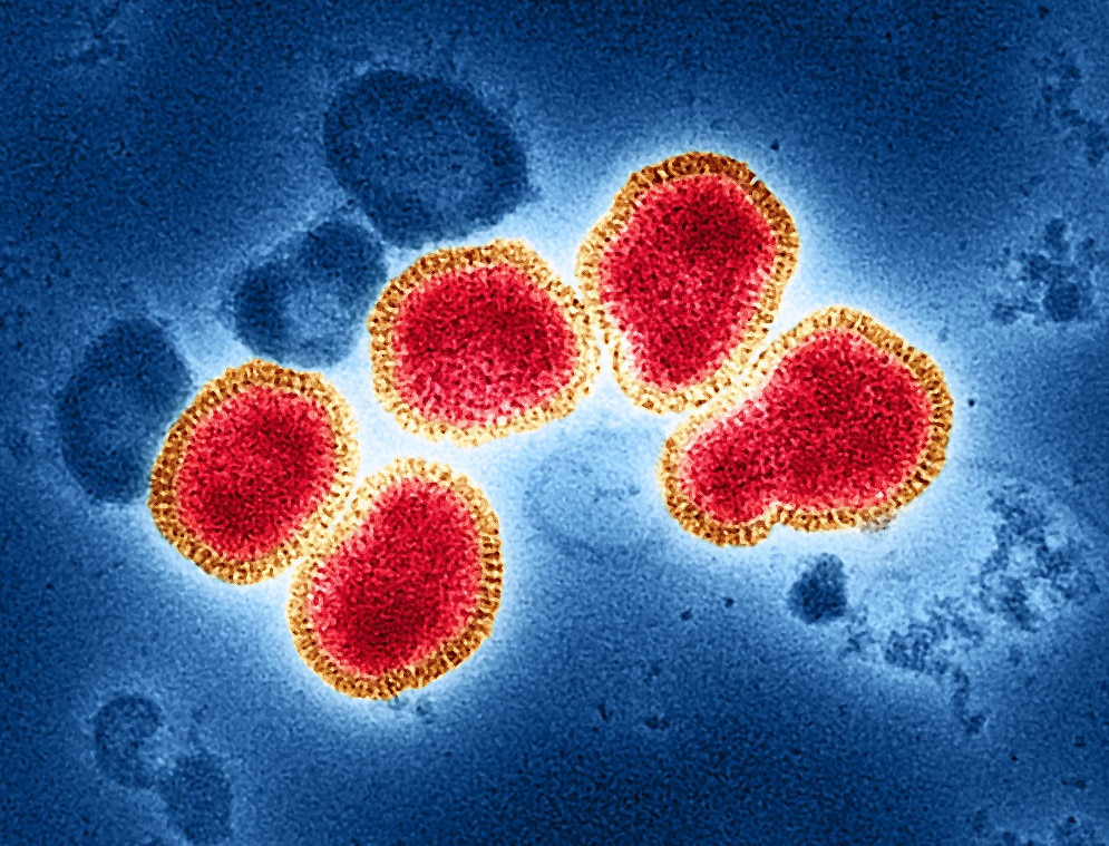 Flu Cases Drop, But Expert Warns Against Complacency (2026)