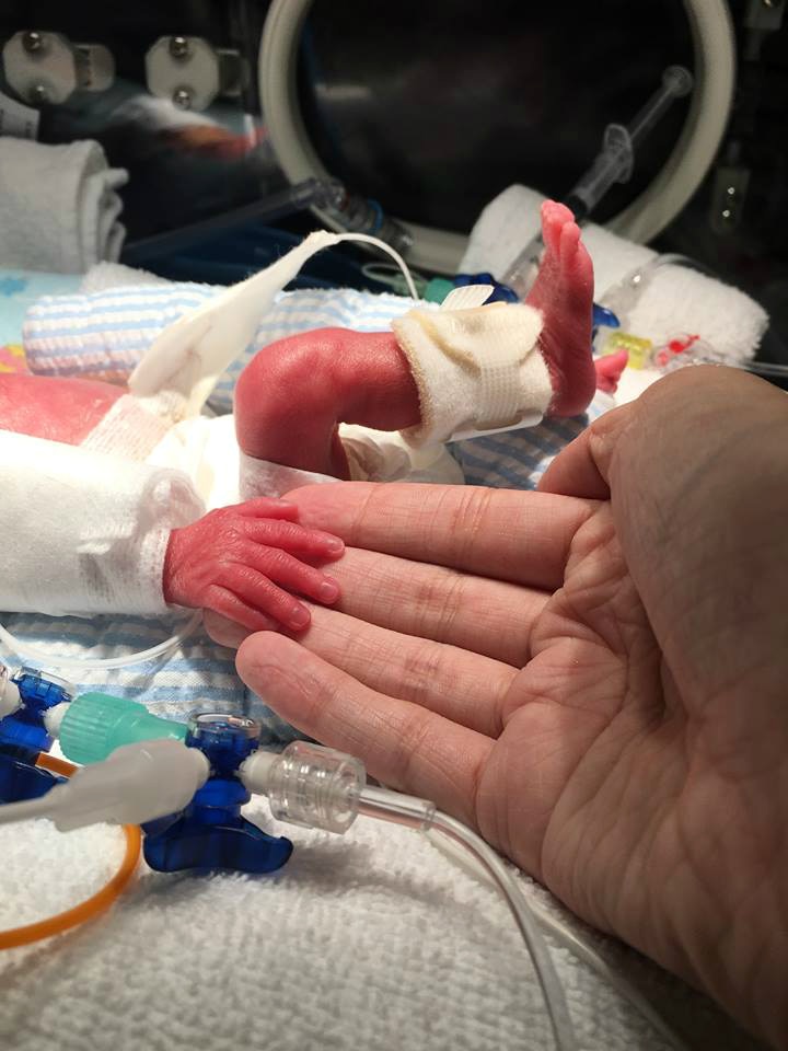 Revolutionary Artificial Placenta: How Perth Researchers Are Saving Premature Babies (2026)