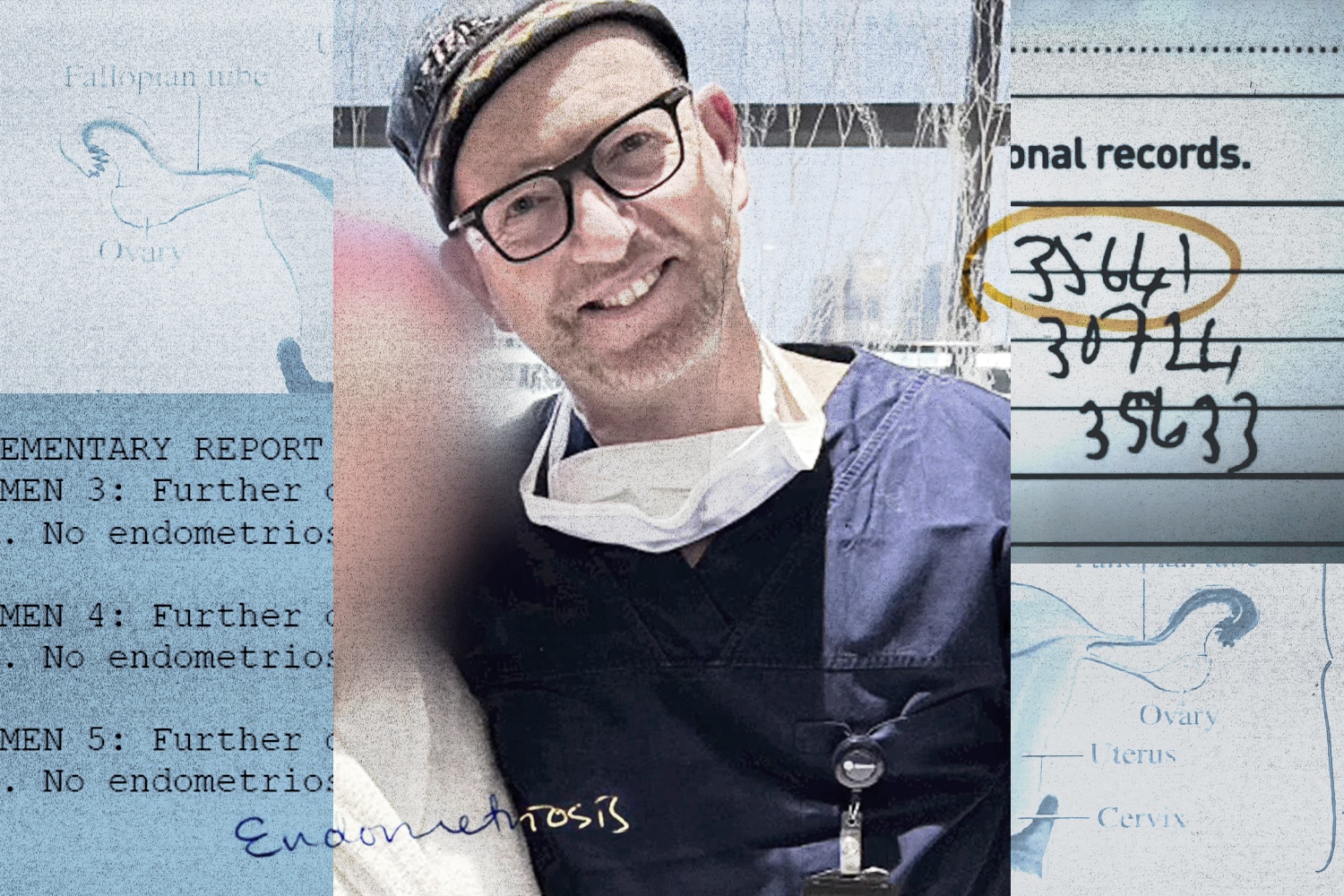 Shocking Investigation: Top Gynaecologist Under Fire for Unnecessary Endometriosis Surgeries (2026)