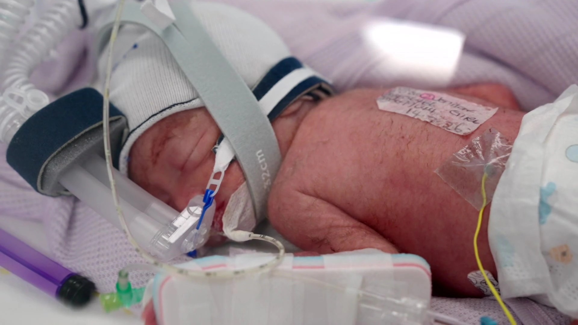 Quadruplets Miracle! Identical Sisters Born from One Egg - An Unbelievable Story (2026)