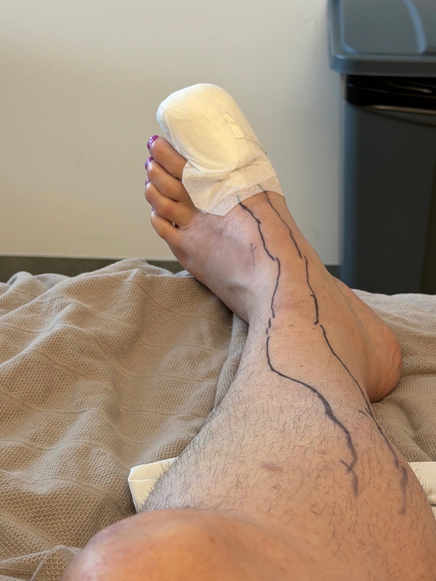 Perth Woman’s Pedicure Nightmare: Sepsis Warning After Toe Infection! (2026)