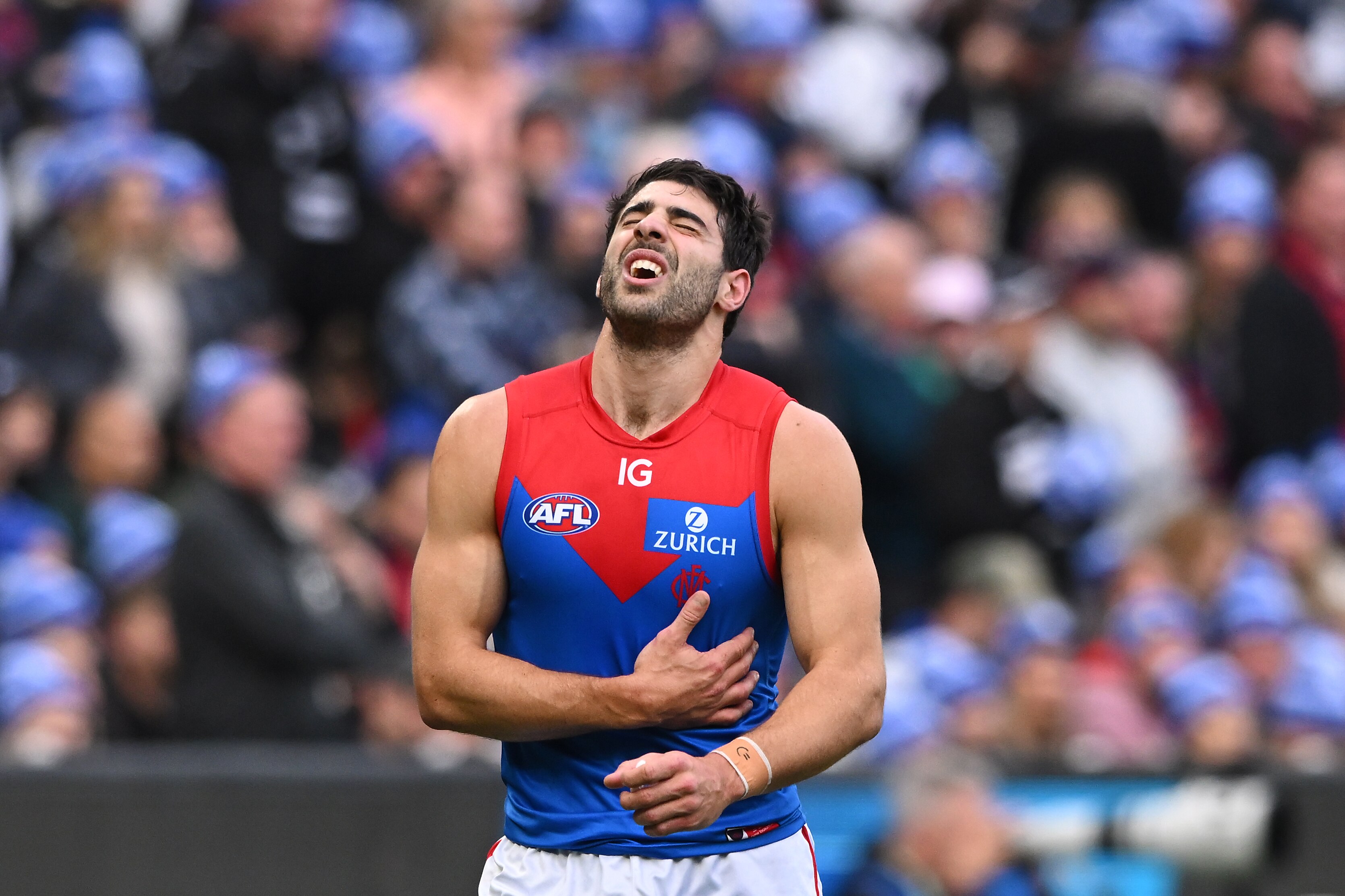 Christian Petracca says internal injuries against Collingwood were ‘equivalent of a car accident’