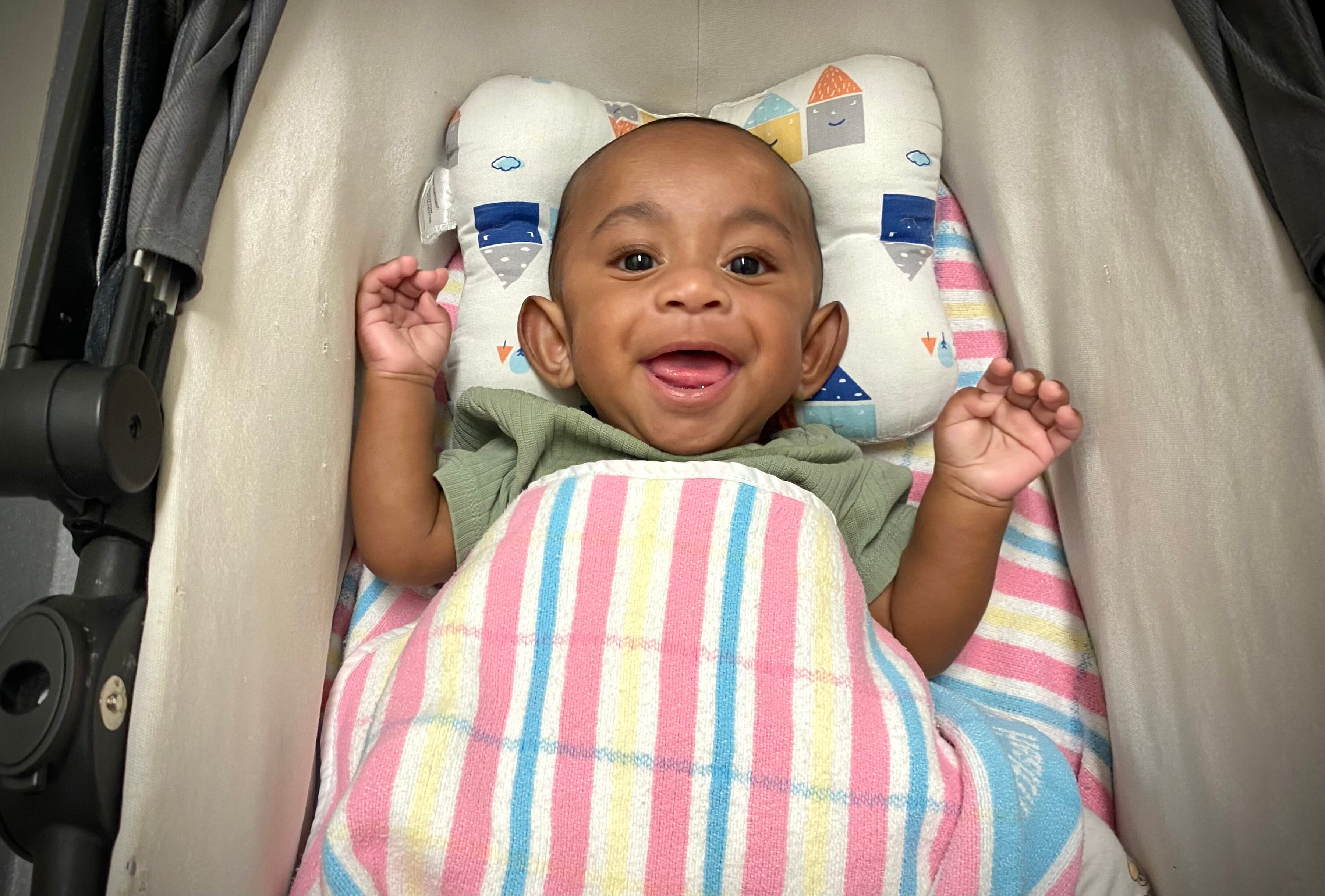 The Race to Save a Conjoined Twin: A Medical Miracle in Papua New Guinea (2026)