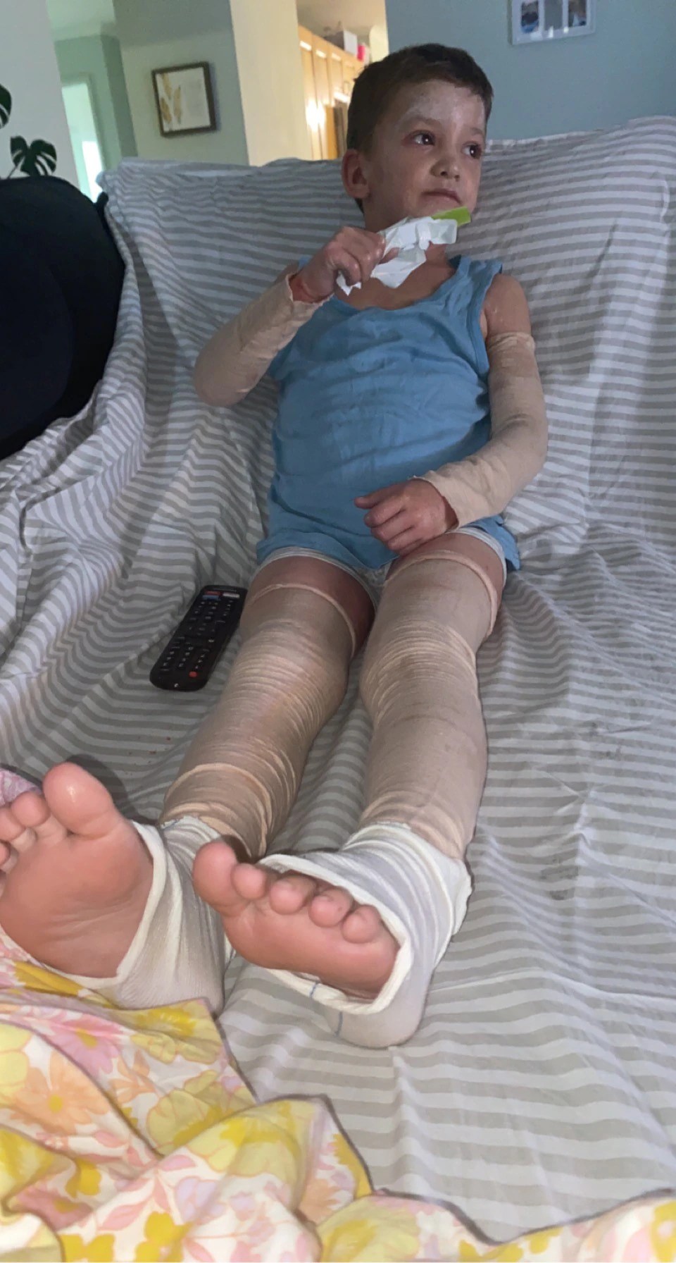 Eczema Medication: A Family's Fight for Affordable Treatment (2026)