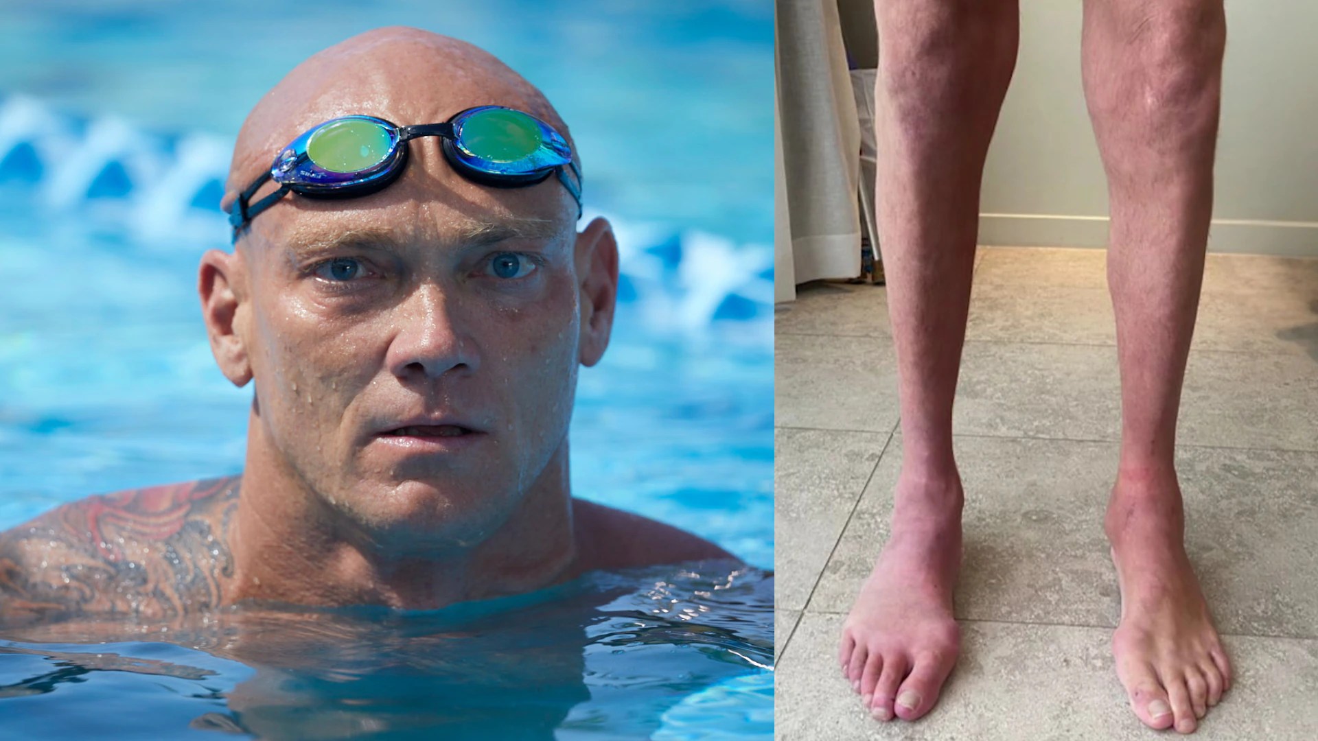 Michael Klim's Journey: Overcoming CIDP and Redefining Success (2026)
