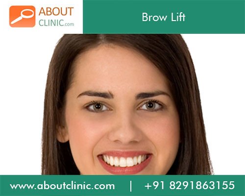 The cost of a brow lift will vary depending on the surgeon, the extent of the changes needed and the surgical method used. Brow-Lift-1 | Looking for Brow Lift Surgery? (also known as â¦ | Flickr