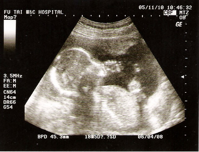 超音波檢查英文sonography Nulaw