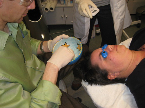 A chemical peel is a cosmetic treatment that removes the top layer of your skin. SkinCeutical Chemical Peel | After derma-planing, Dr. Adam Sâ¦ | Flickr