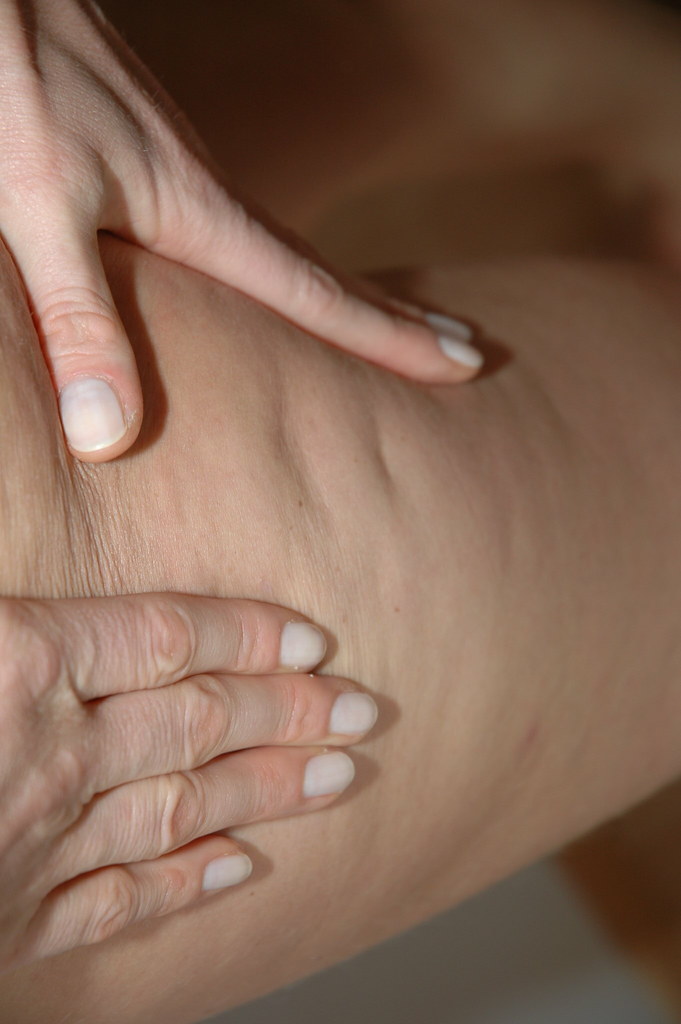 Im groben gibt es 2 arten von lymphdrainagen. Zellulitis-Lymphdrainage | orangenhaut, bekaempfen