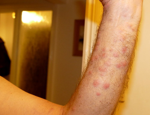 So, when you see a moth larva on the ceiling, it means that it's looking for a place to hide. Brown Tailed Moth Caterpillar Bites | Beware I have over