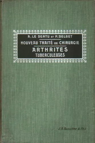 Arthrites Tuberculeuses