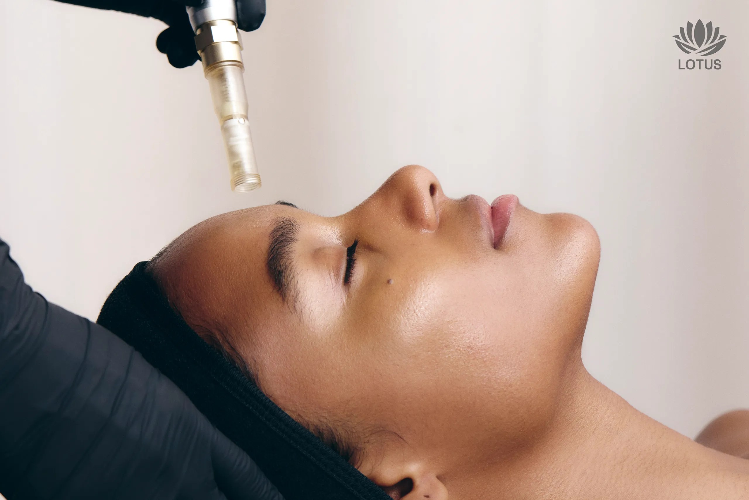 SkinStylus en San Leandro: Rejuvenecimiento y Lifting sin Cirugía / SkinStylus in San Leandro: Rejuvenation and Lifting Without Surgery