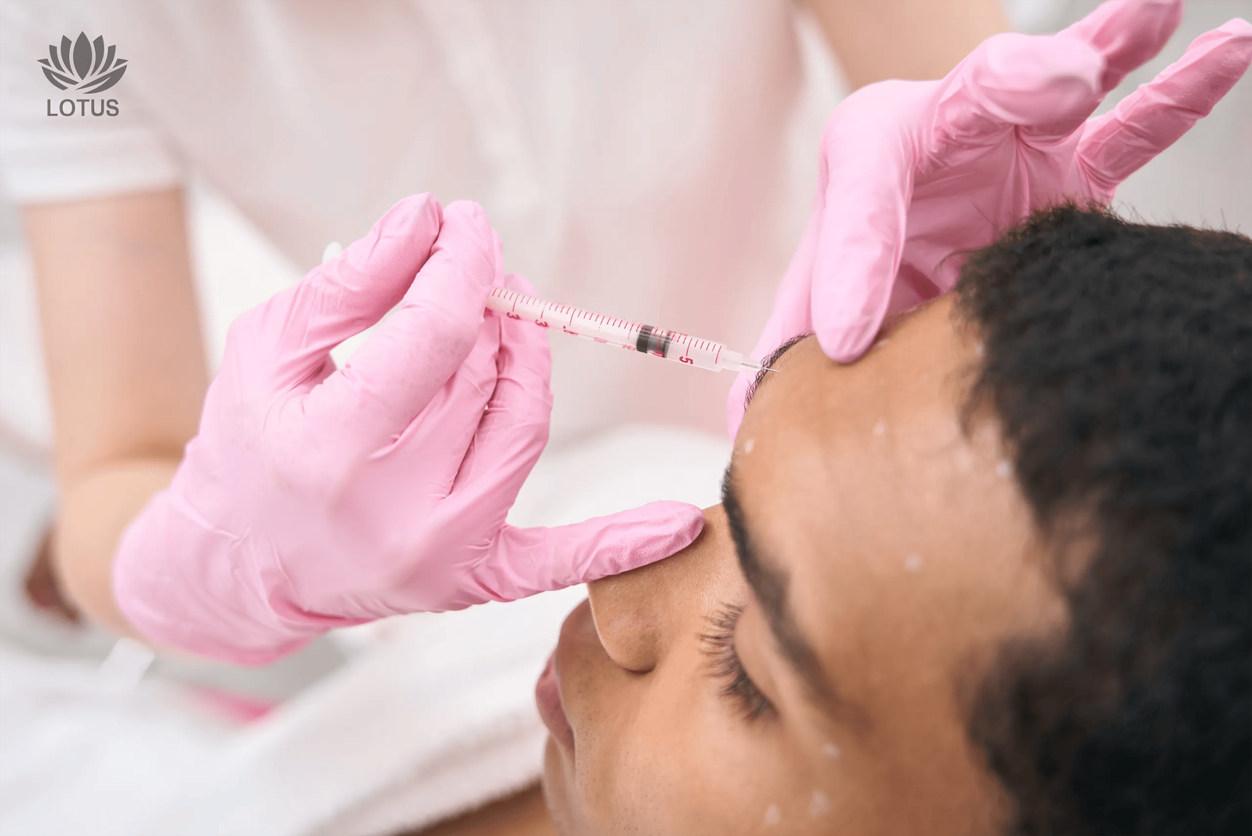 Baby Botox en San Leandro | Toxina Botulínica Preventiva en Lotus // Baby Botox in San Leandro | Preventive Botulinum Toxin at Lotus