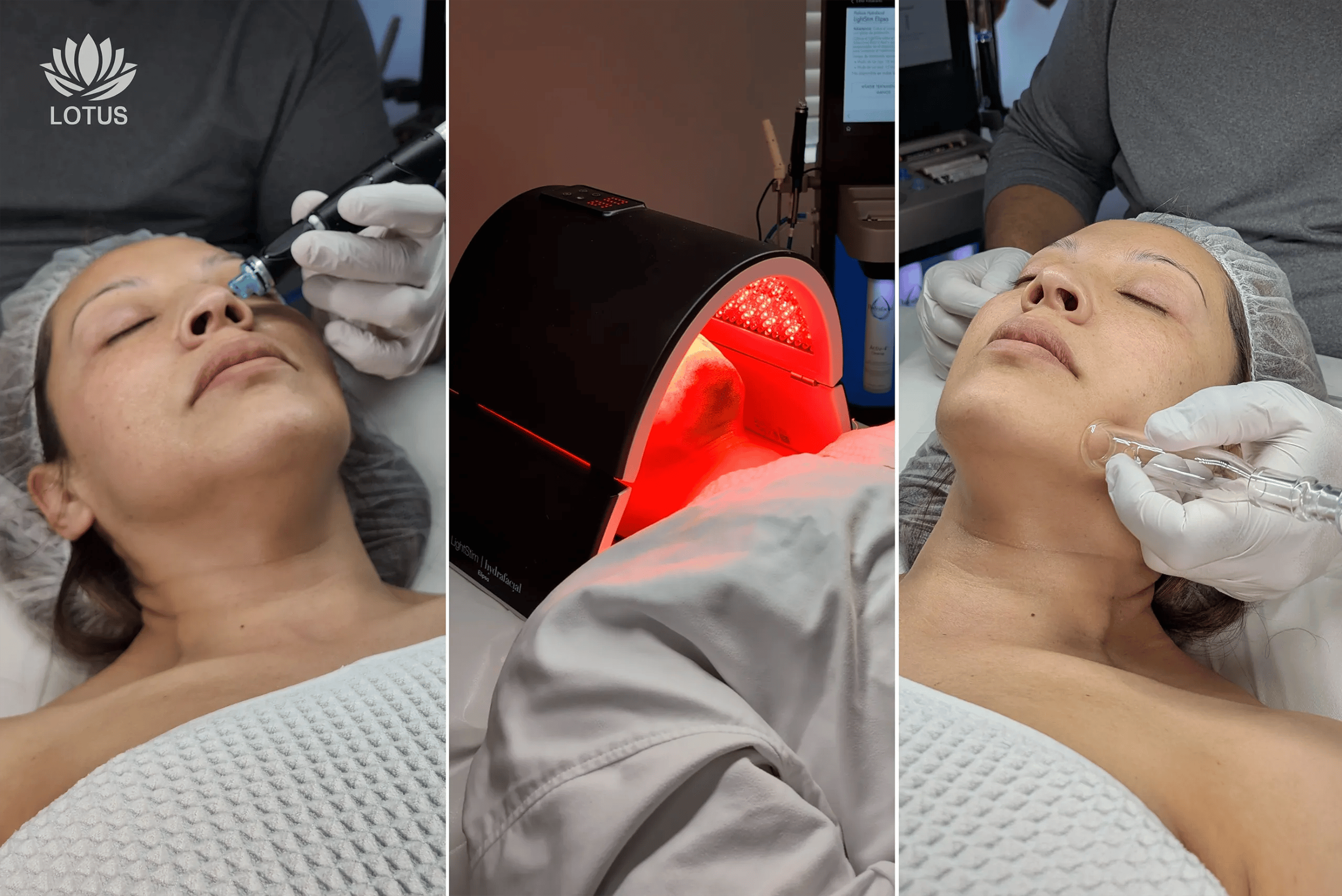 Tipos de Hydrafacials Lotus | Signature, Deluxe y Platinum // Types of Hydrafacials in Lotus | Signature, Deluxe & Platinum