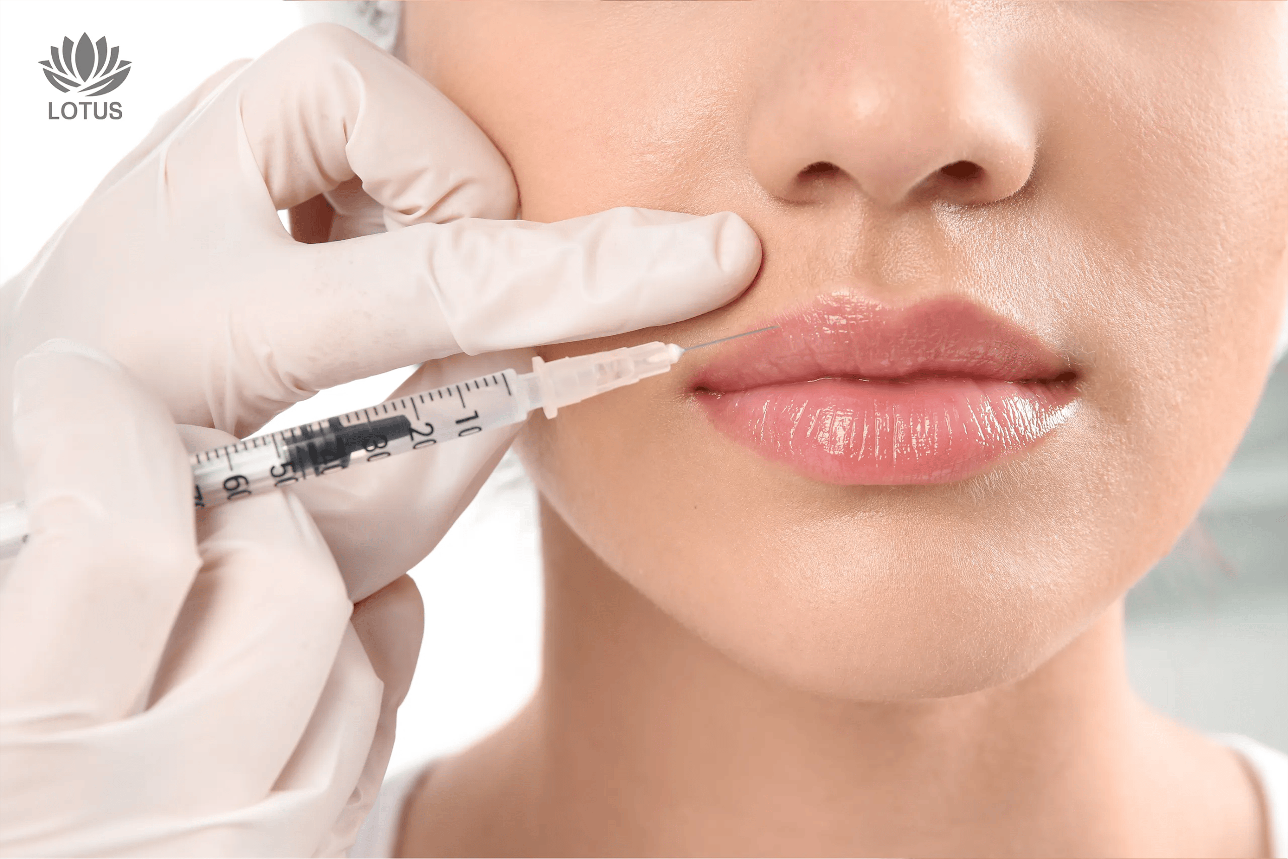 Relleno de Labios o Labios Voluminosos ¿Cual es para mí?