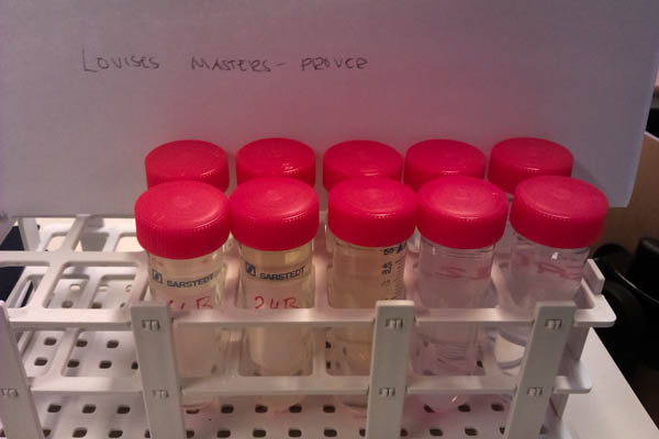 Färdiga för analys.