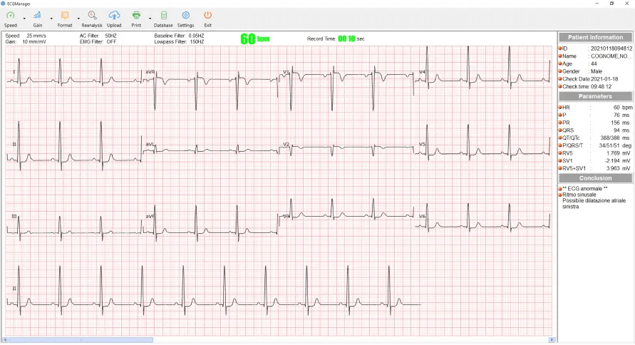 ECG manager software