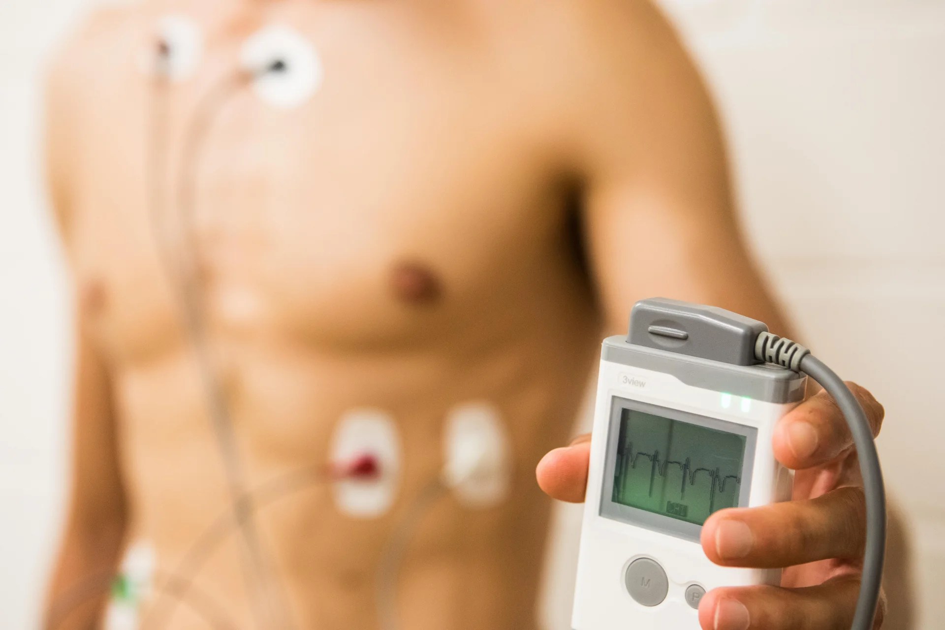 Sistema Holterr 3/12 canali in funzione