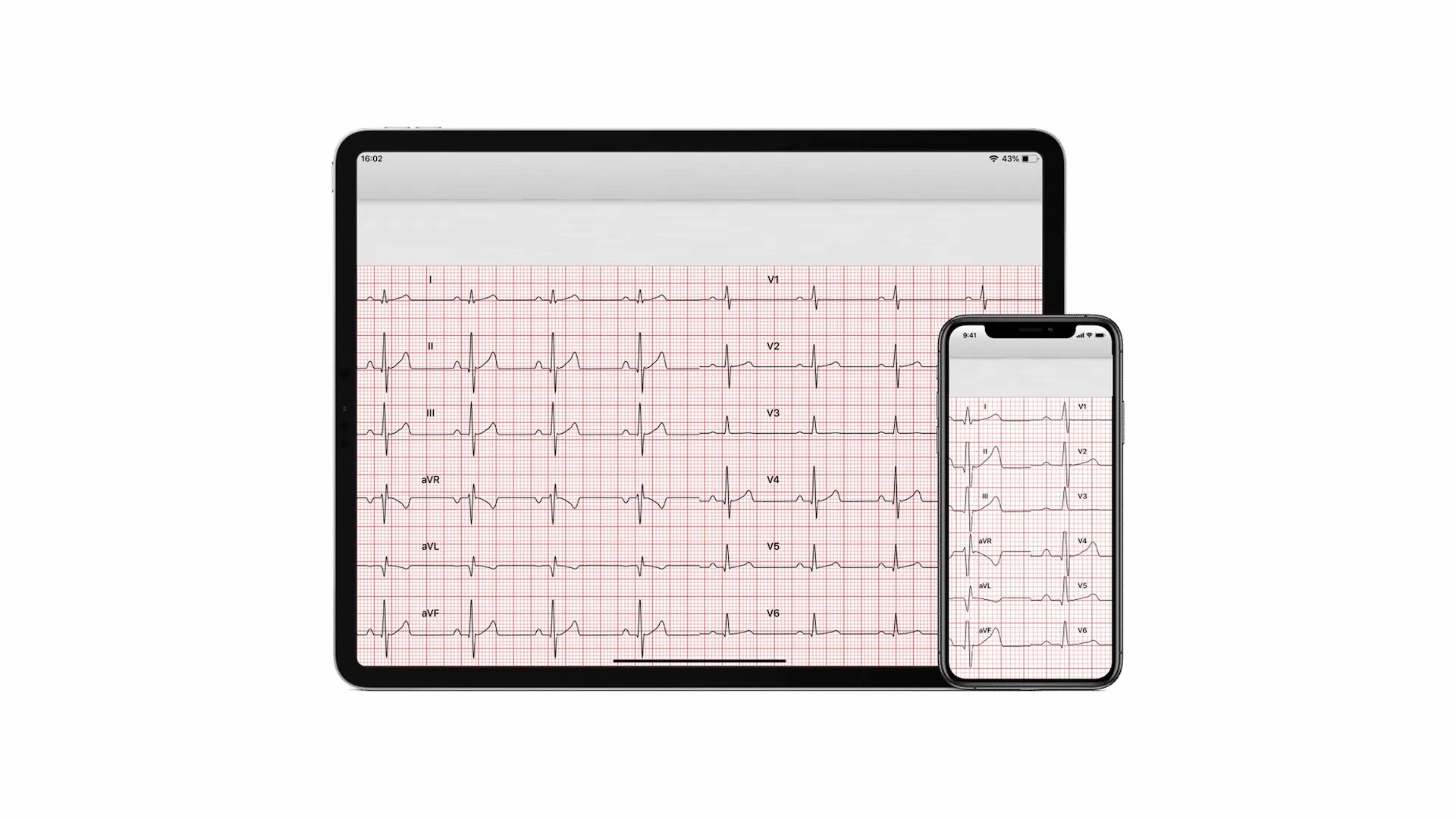 Software per i sistemi holter