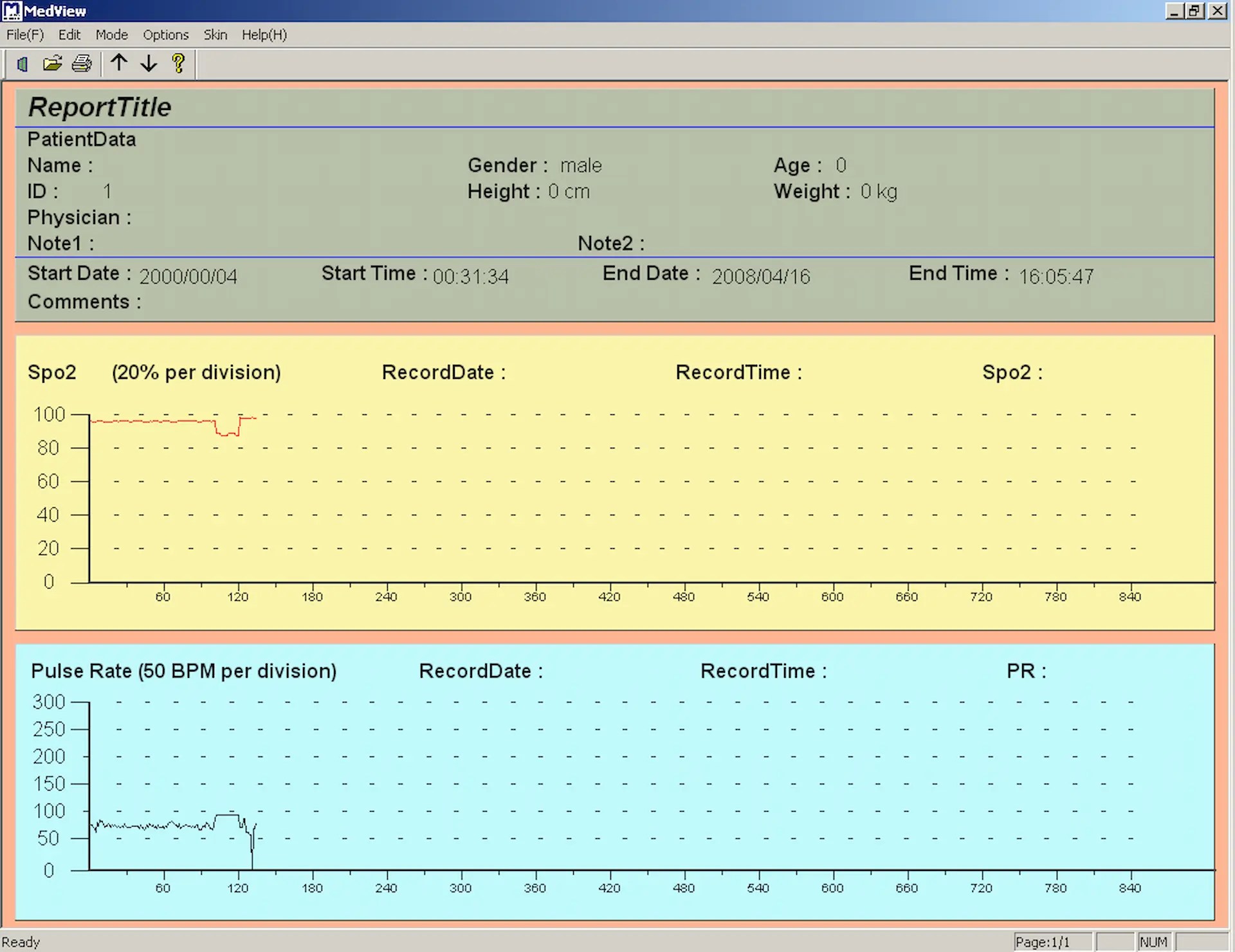 Software per saturimetro