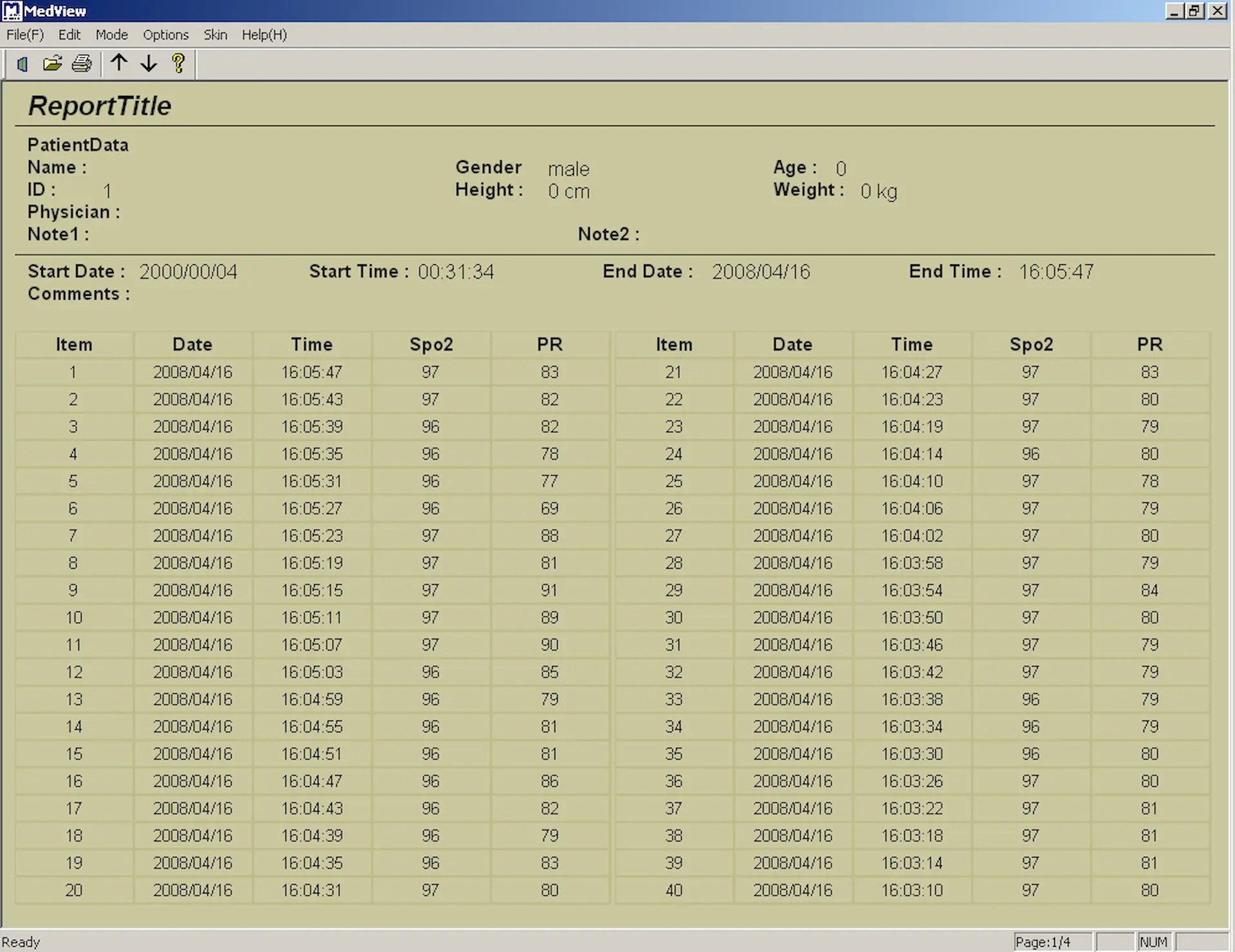 Software per saturimetro
