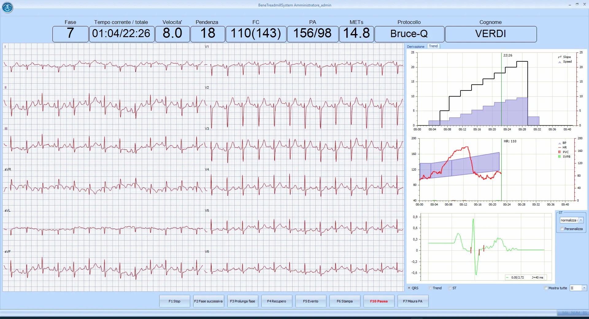 Software della prova da sforzo
