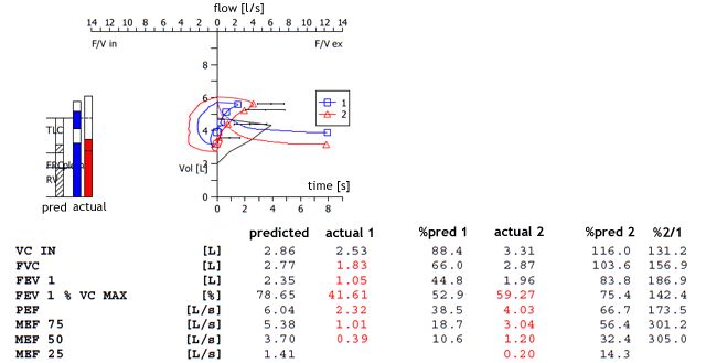 Basics Lungfunction Net - Beautiful Light Photo - Full HD