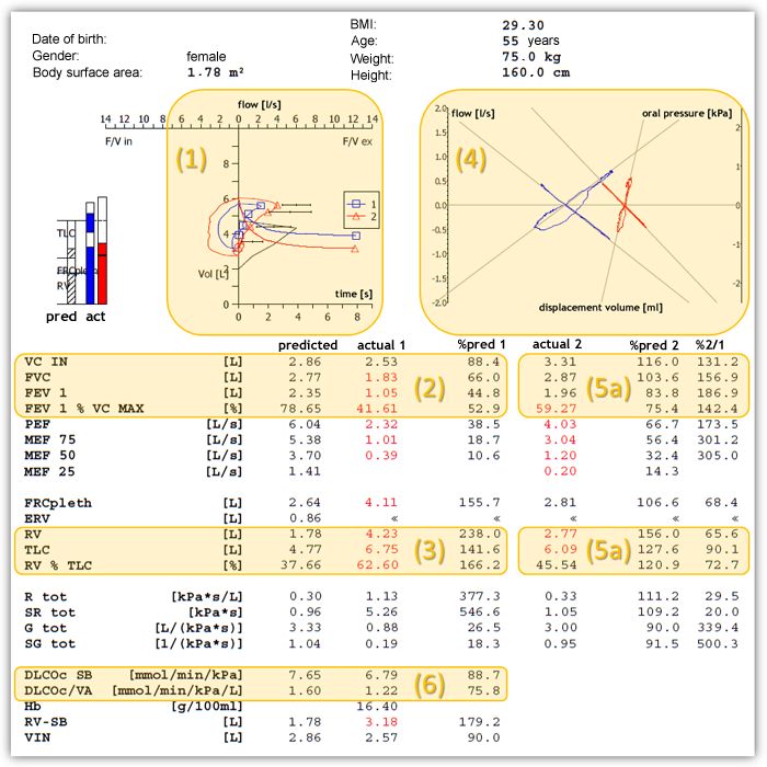 Normal Findings Interpretation Lungfunction Net - Artistic 4K Ocean Backgrounds | Free Download