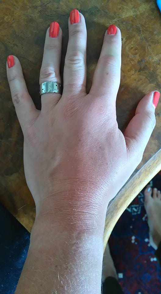The ring came off before it was too late