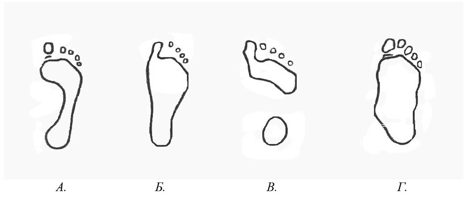 Стопа - особлива рефлексогенна зона нашого організму (2023)