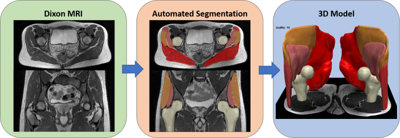Github Valmik Muscle Segmentation Machine Learning Models To Segment - Download Premium Colorful Art | 8K