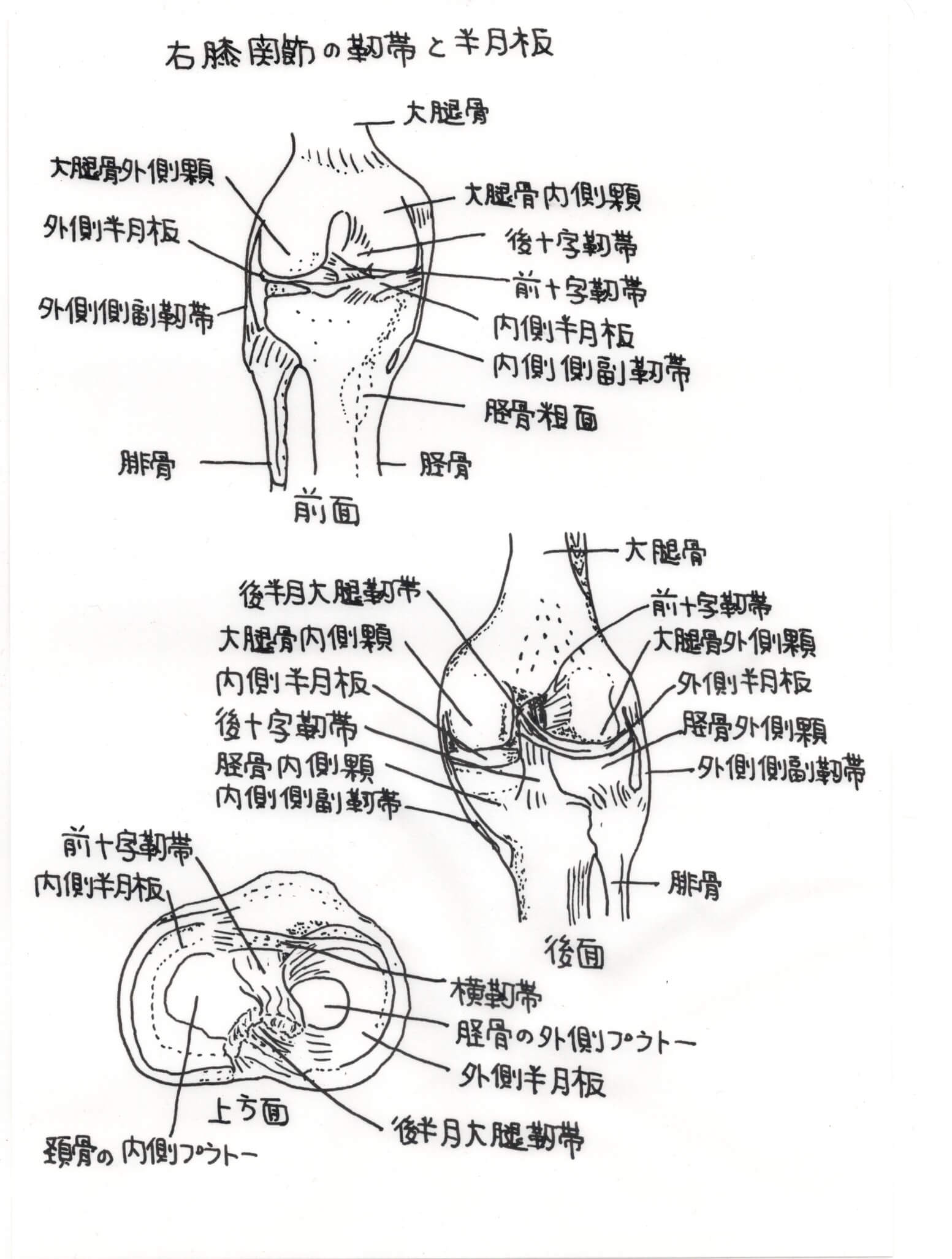 O脚、X脚と膝の痛み