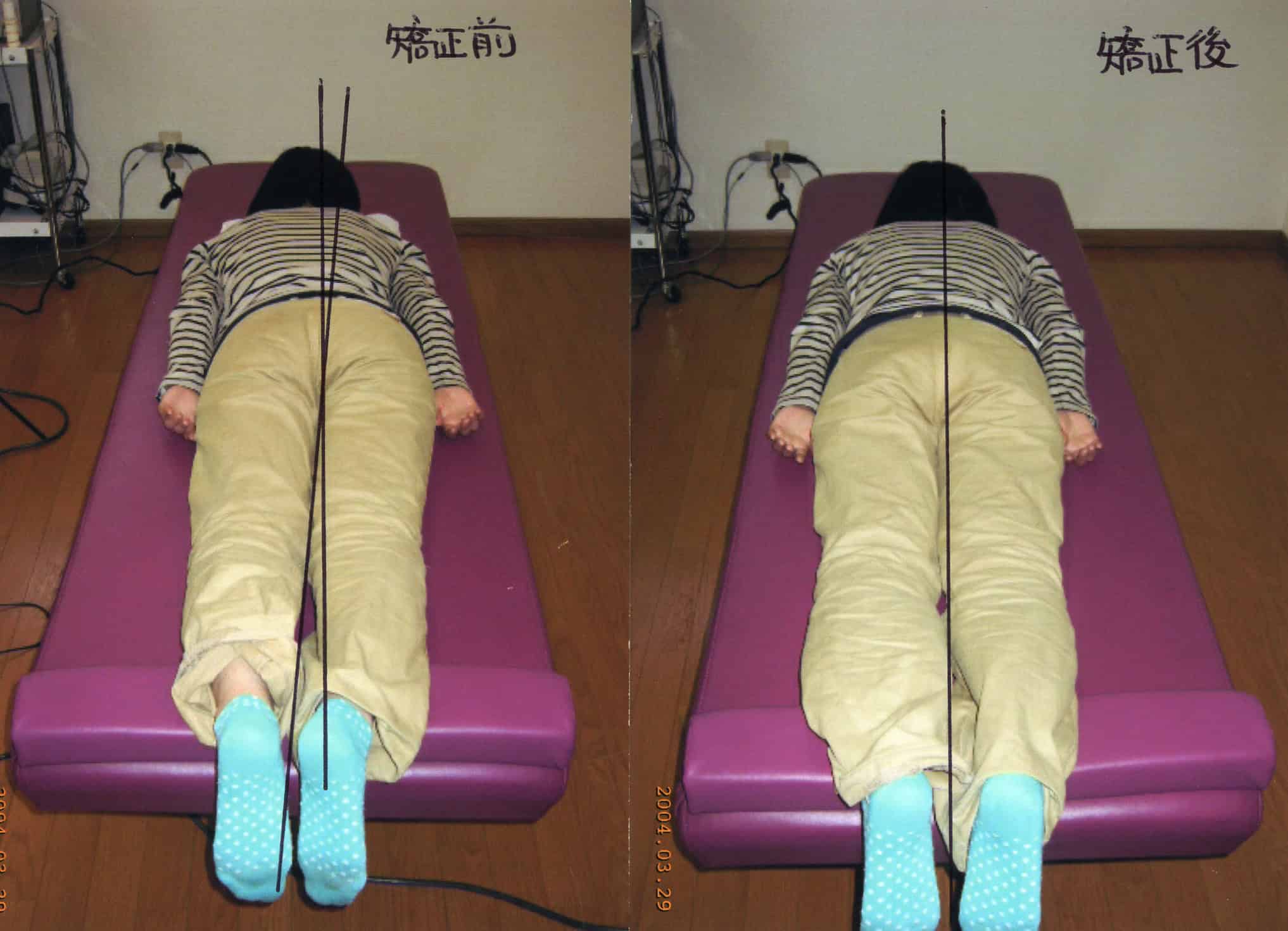 スタッフ紹介前田整体院高知
身体の歪み矯正