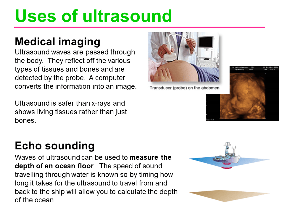 Slide13