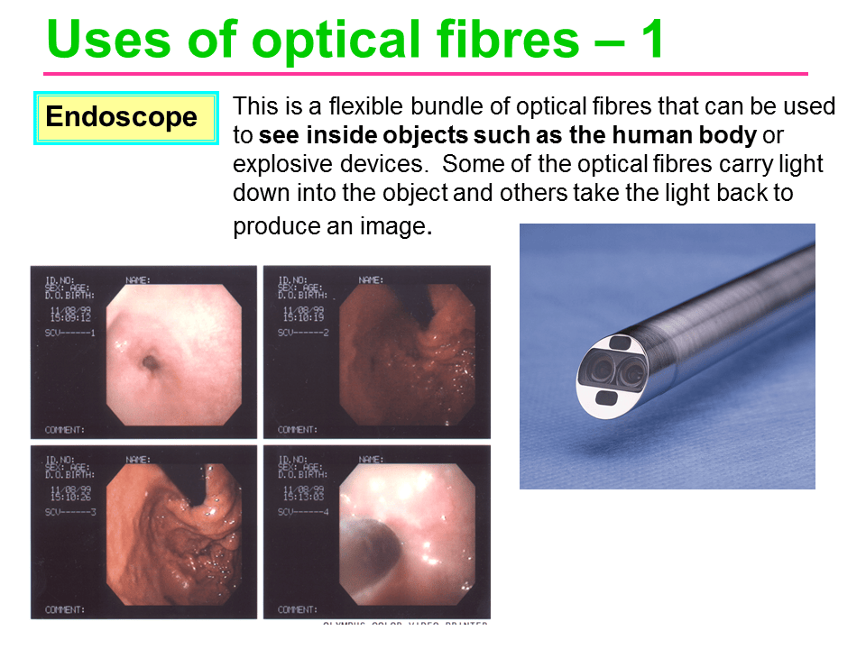 Slide45