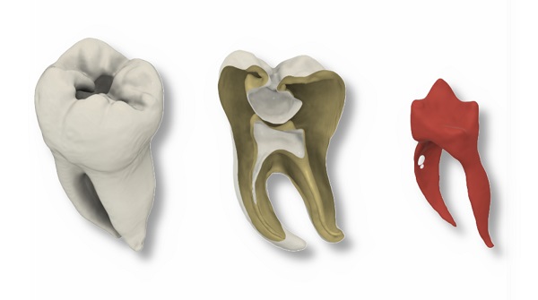 Ein 3D-gedruckter Zahn, der alles kann: Das UKW setzt neue Maßstäbe – praxisnah, wissenschaftlich fundiert und zukunftsorientiert
