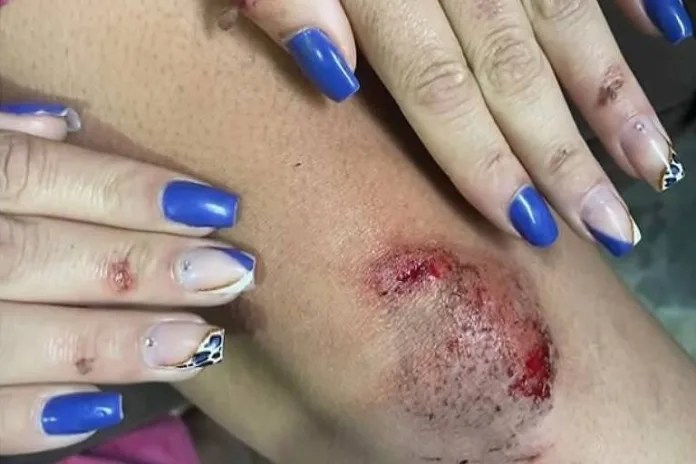 Jovem se joga de carro