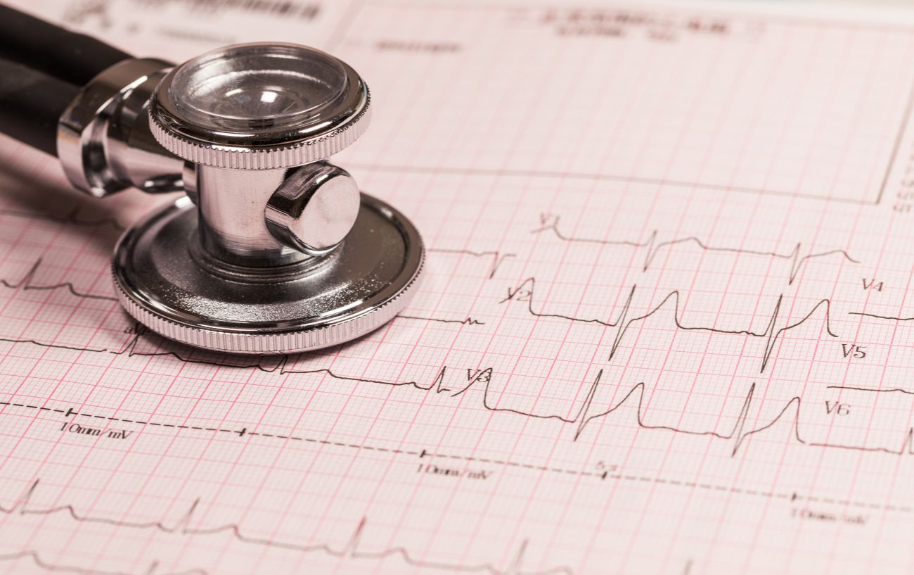 Interpreting High and Low HRV Values