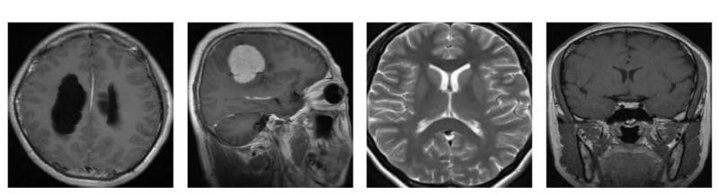 Github Jmejia22 Braintumorclassification Using Deep Learning To - Gorgeous Space Background - Mobile