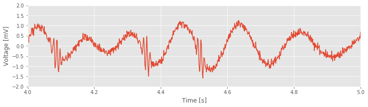 Github Catniplab Crossfrequencycoupling Estimate Cross Frequency - Landscape Textures - Elegant HD Collection