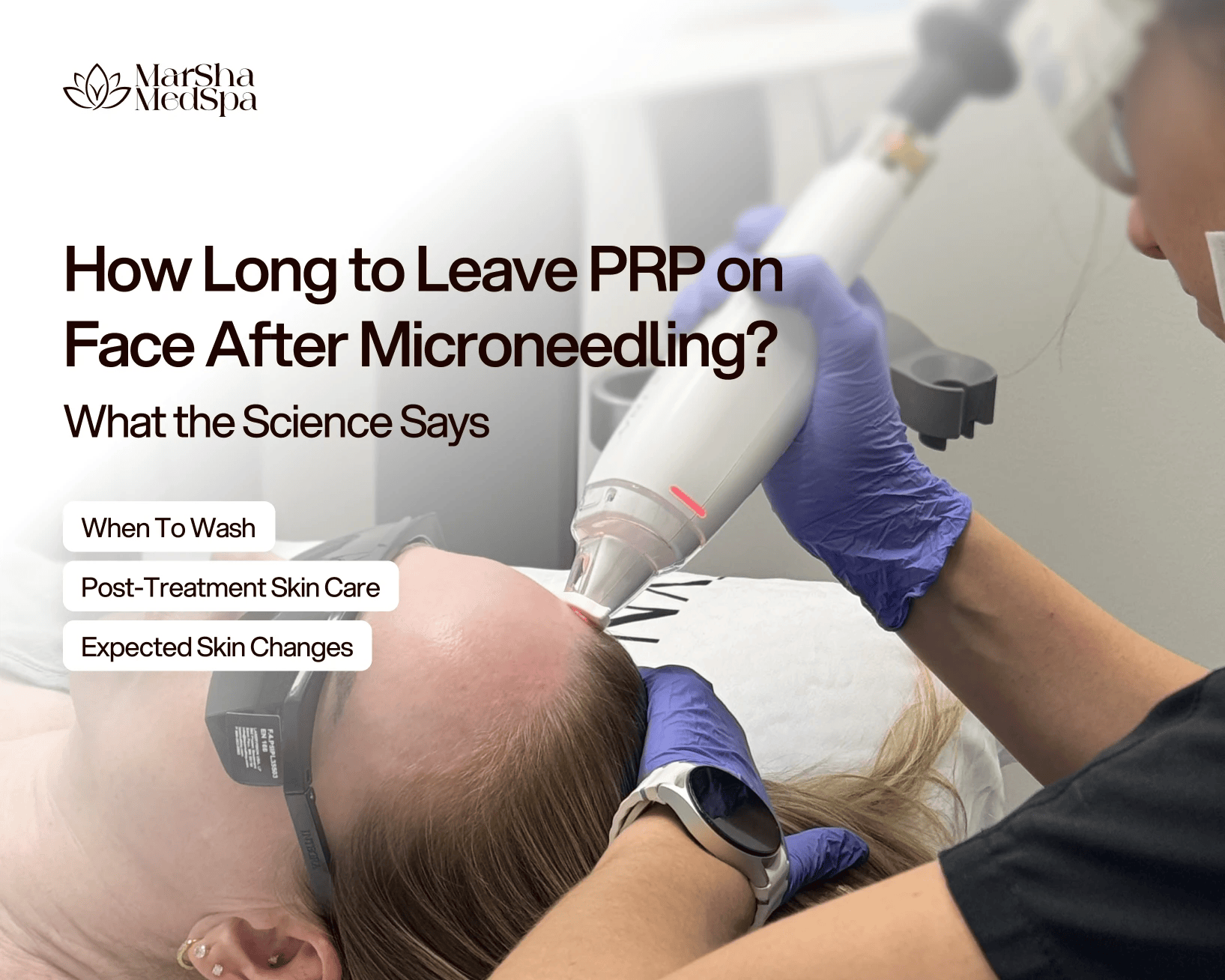 How Long to Leave PRP on Face After Microneedling? What the Science Says