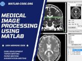 Implementing Medical Image Processing Using Matlab Code Support
