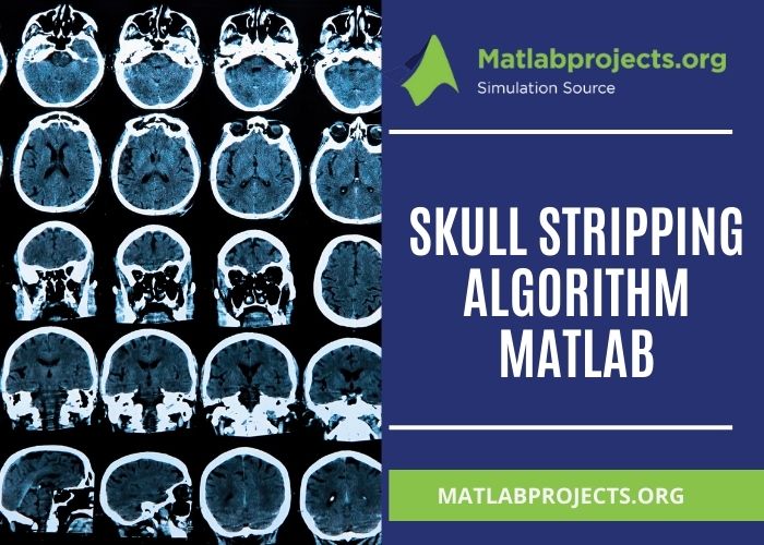 Processing Steps For Skull Stripping Using Python Top 10 Latest Algorithm - Professional Mobile Sunset Pictures | Free Download