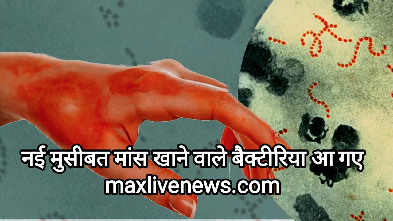 नई मुसीबत मांस खाने वाले बैक्टीरिया आ गए \ Flesh - eating bacteria arrived in trouble 
