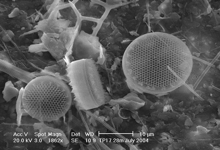 Diatoms of the genus Chaetoceros seen under a scanning electron microscope